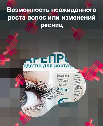 Биматопрост для роста ресниц вред или польза